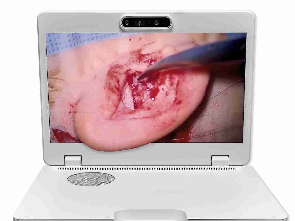 达擎之＂Heads-up 3D显微手术显示系统＂，，，，整合4K裸眼3D显示及眼球追踪系统，，，具备快速追踪人眼移动位置功能，，减轻医师长时间维持固定姿势的负担，，，，让医师能有更宽广清晰的3D立体视野及更舒适的姿势来执行手术。。